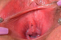 Fre Gape My Pussy Login And Password s3